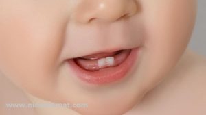 روشهای کاهش درد دندان درآوردن کودک